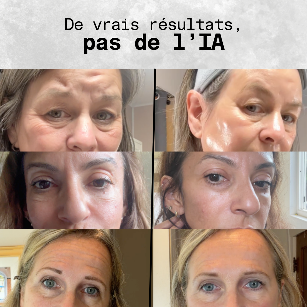 [lang:fr] Kalysta The Peptide Mask - masque hydrogel peptides